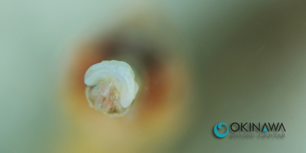 恩納村 ダイビング